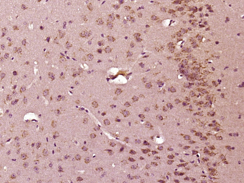 14 - C9orf172 Rabbit pAb AP55945
