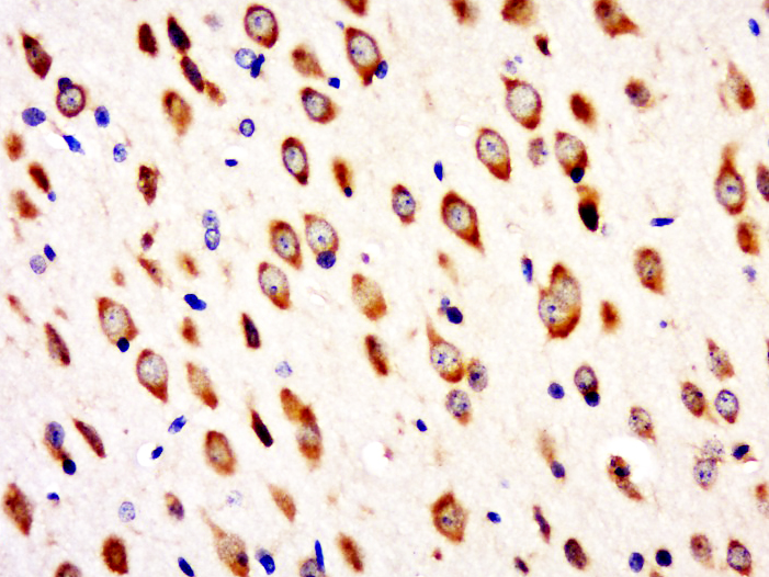 14 - C9orf85 Rabbit pAb AP55958