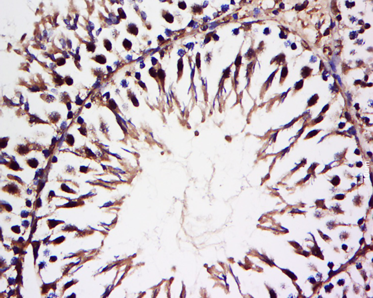 14 - HECT E3 ubiquitin ligase Rabbit pAb AP55999