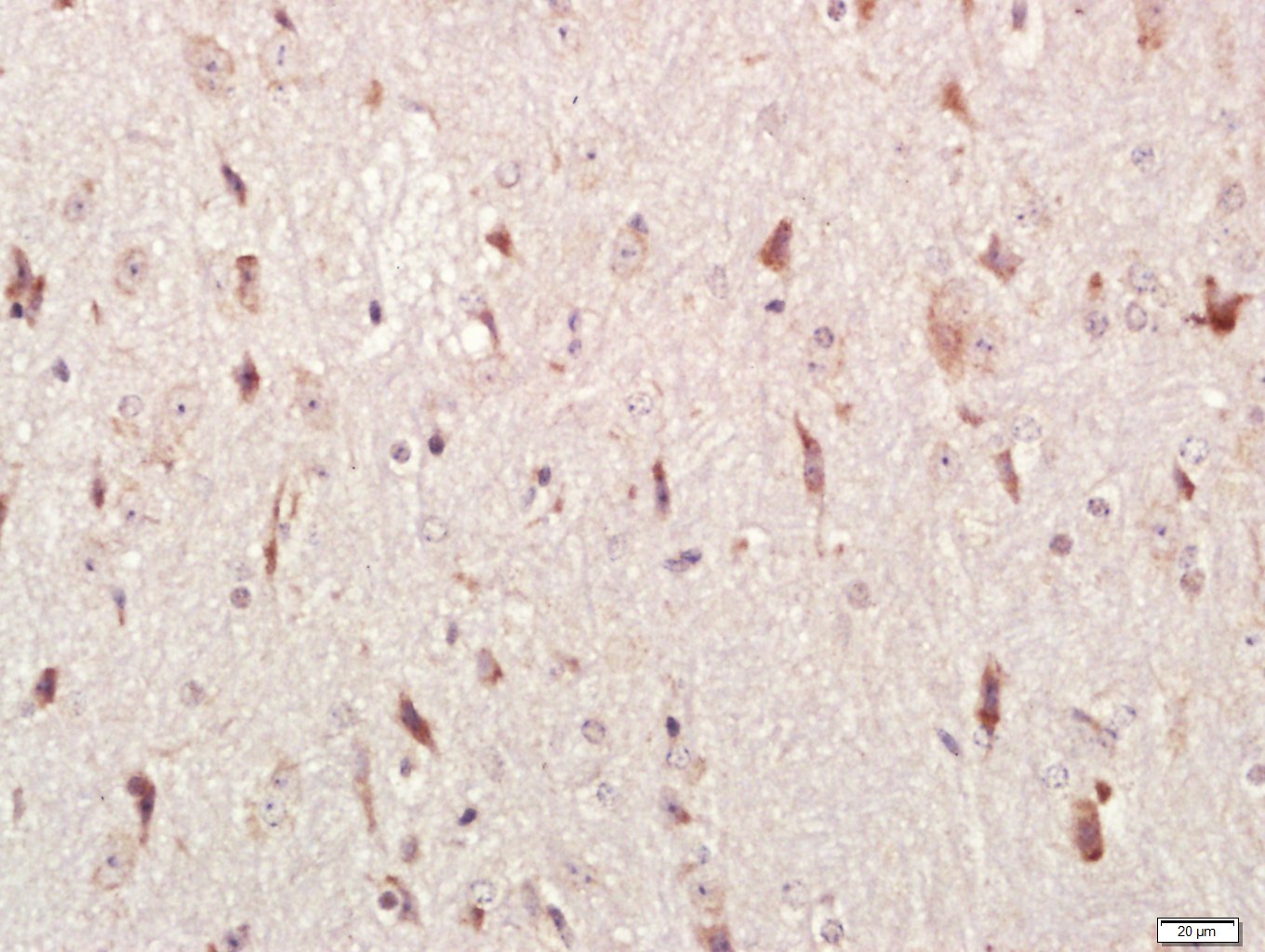 14 - HEG1 Rabbit pAb AP56001