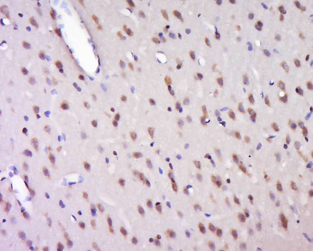 14 - HELZ Rabbit pAb AP56002