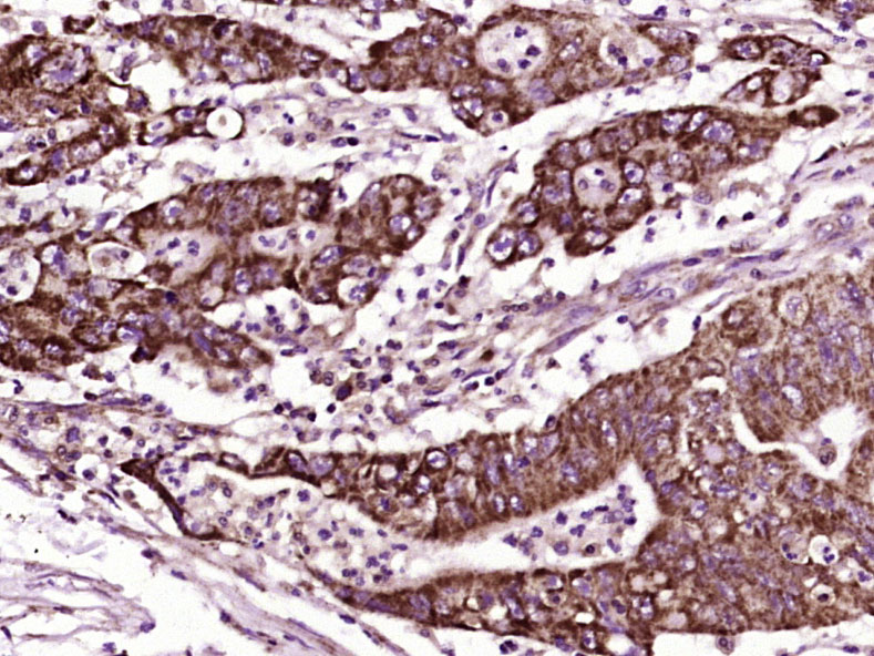 14 - CDH23 Rabbit pAb AP56023