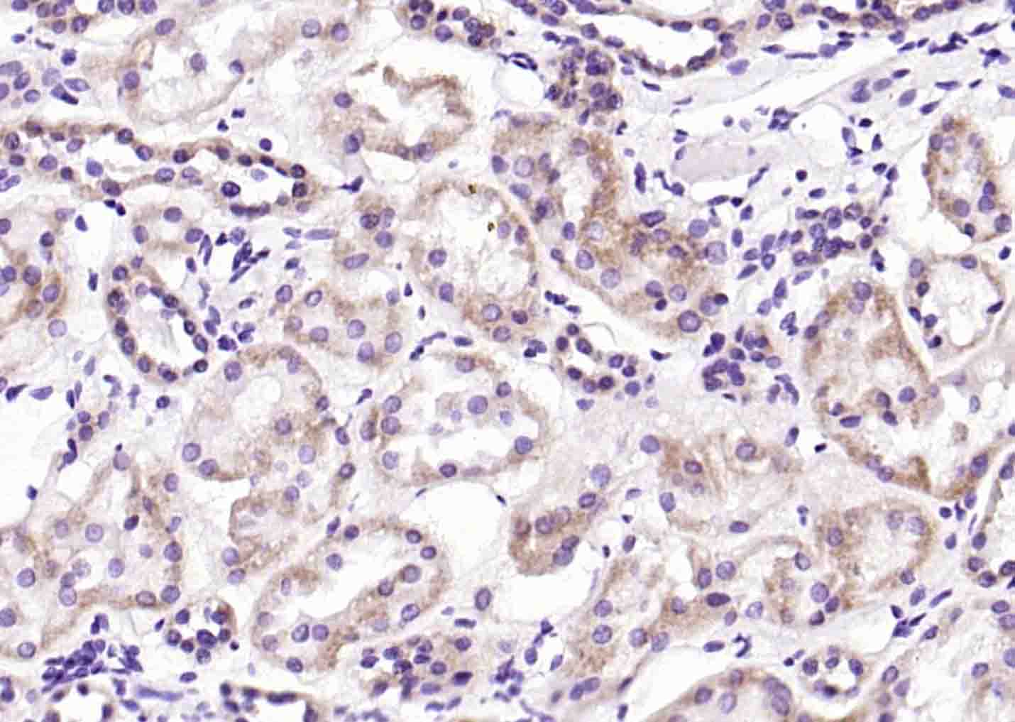14 - Iduronate 2 sulfatase Rabbit pAb AP56033