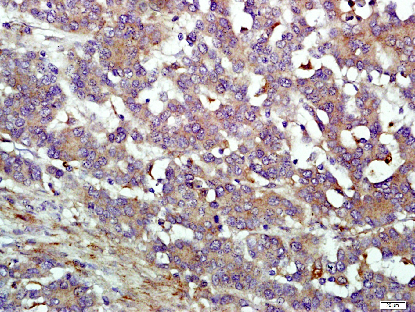 14 - IFIT1B Rabbit pAb AP56037
