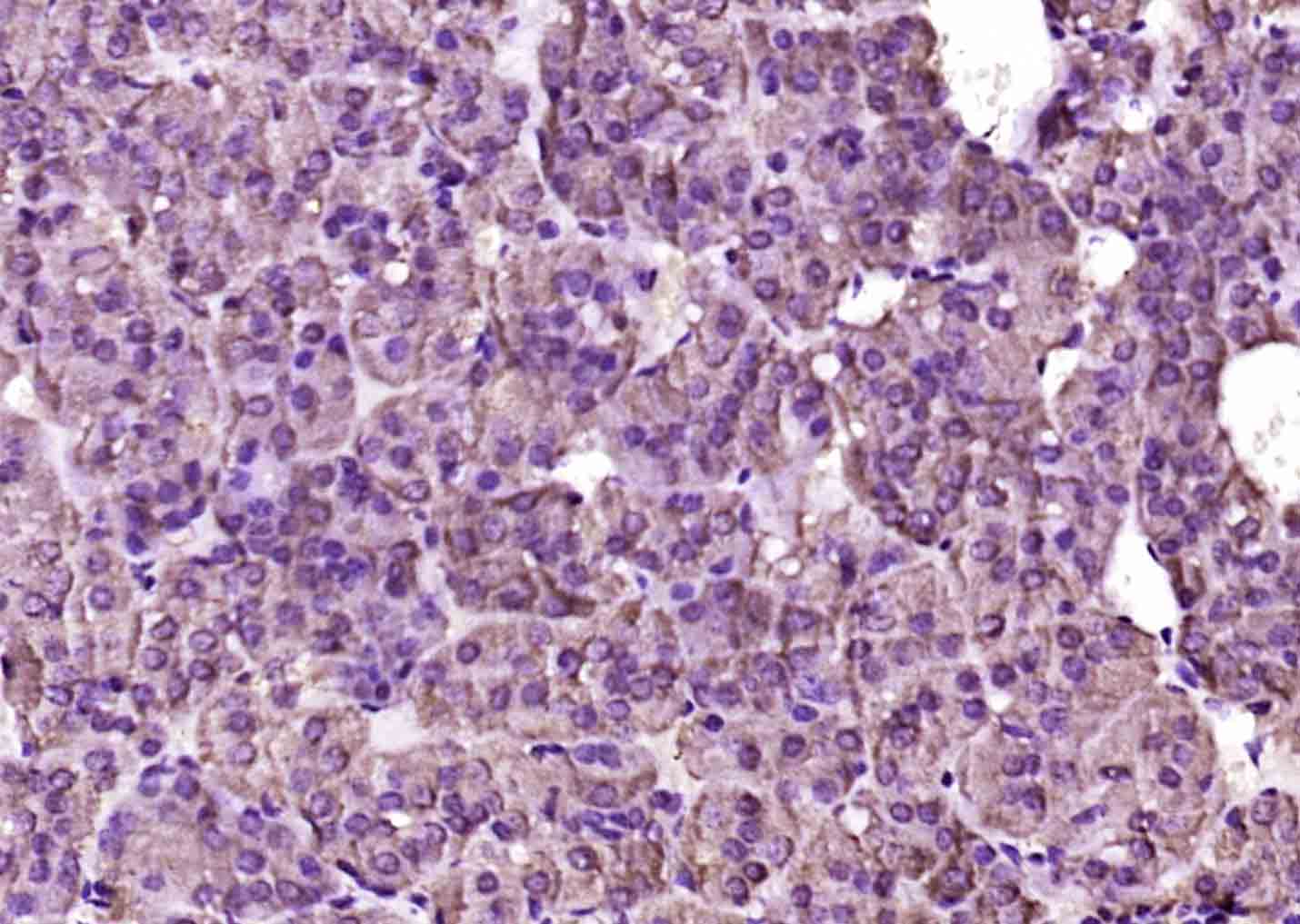 14 - IFT140 Rabbit pAb AP56040