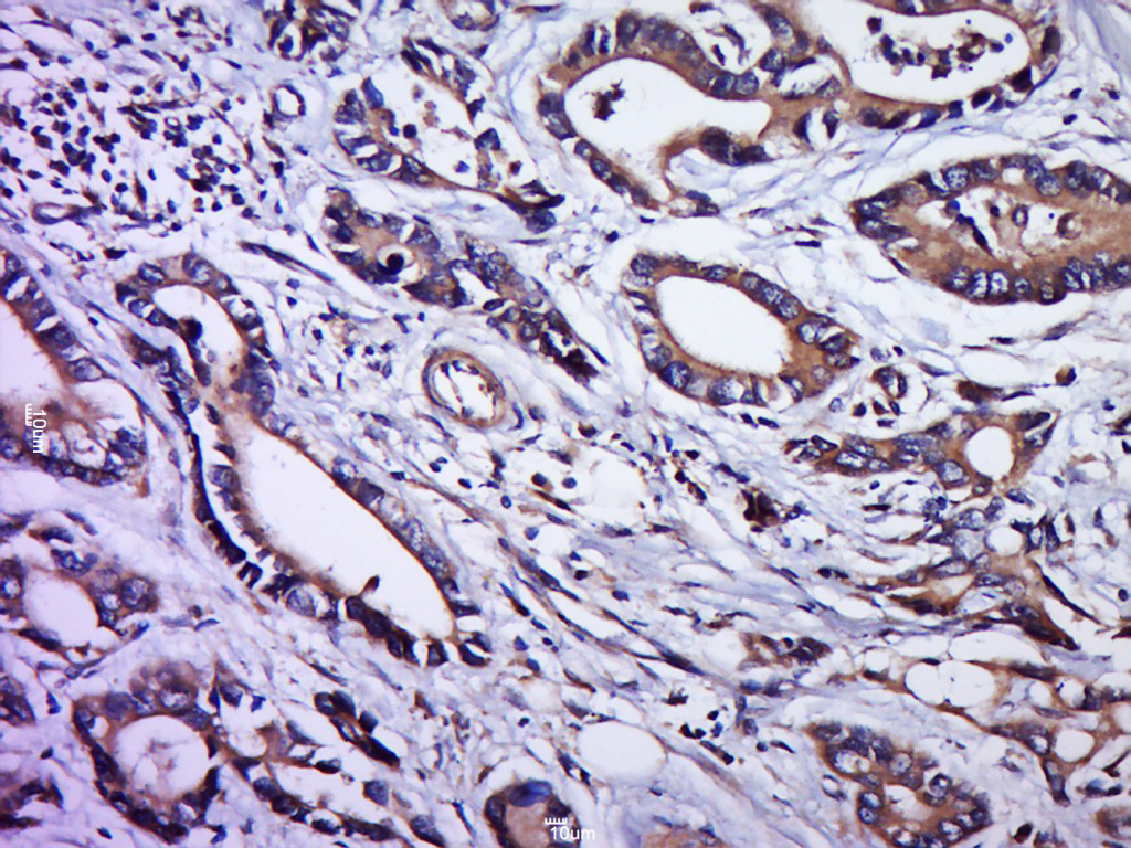 14 - IGFL2 Rabbit pAb AP56046