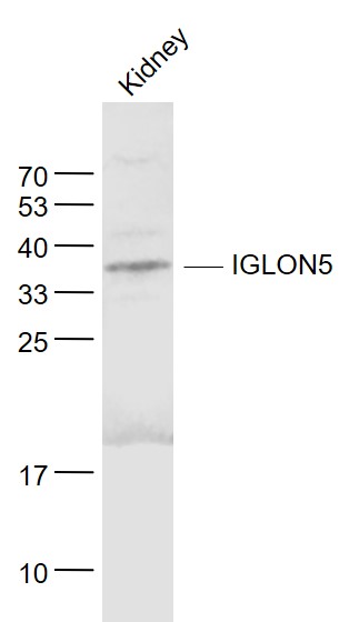 1 - IGLON5 Rabbit pAb AP56048