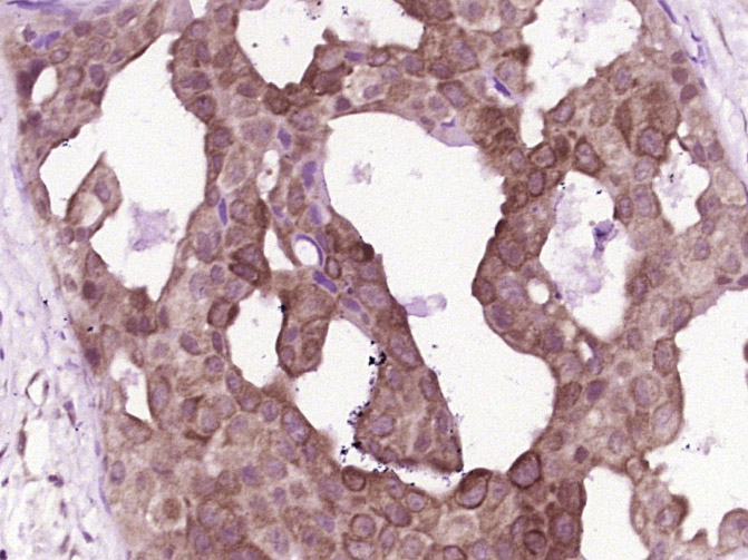 14 - Calpain 2 Rabbit pAb AP56055