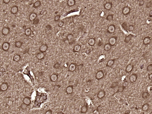 14 - FAM55C Rabbit pAb AP56058