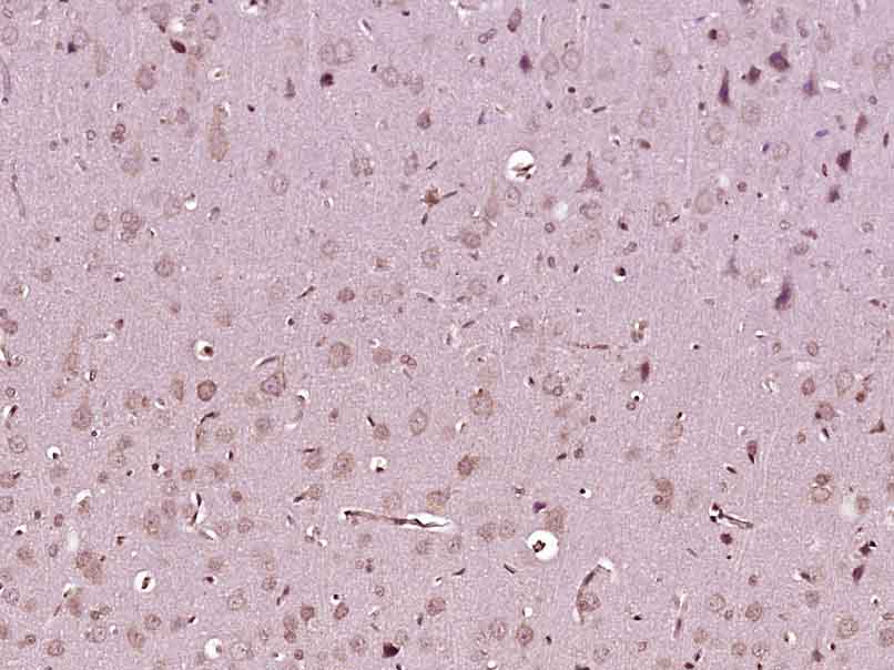 14 - FAM83B Rabbit pAb AP56066