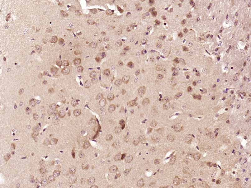 14 - FAM83E Rabbit pAb AP56067