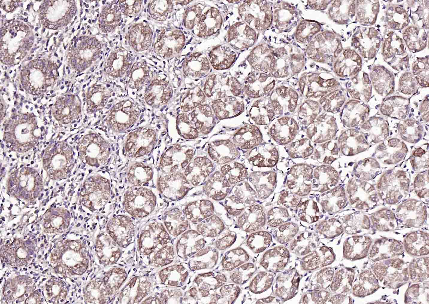 14 - FAM83H Rabbit pAb AP56069