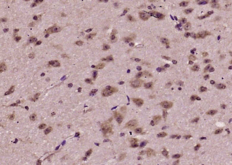 14 - FBXO10 Rabbit pAb AP56088