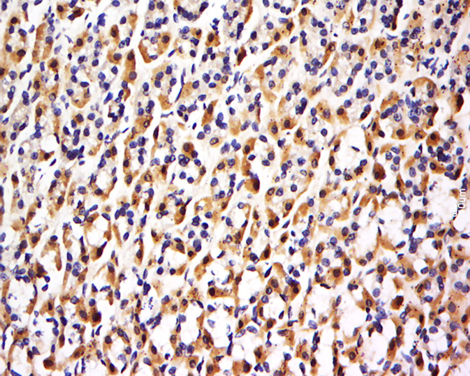 14 - FBXO48 Rabbit pAb AP56094