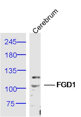 1 - FGD1 Rabbit pAb AP56107