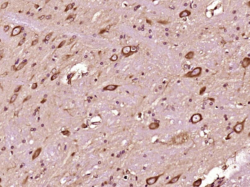 14 - FGD1 Rabbit pAb AP56107