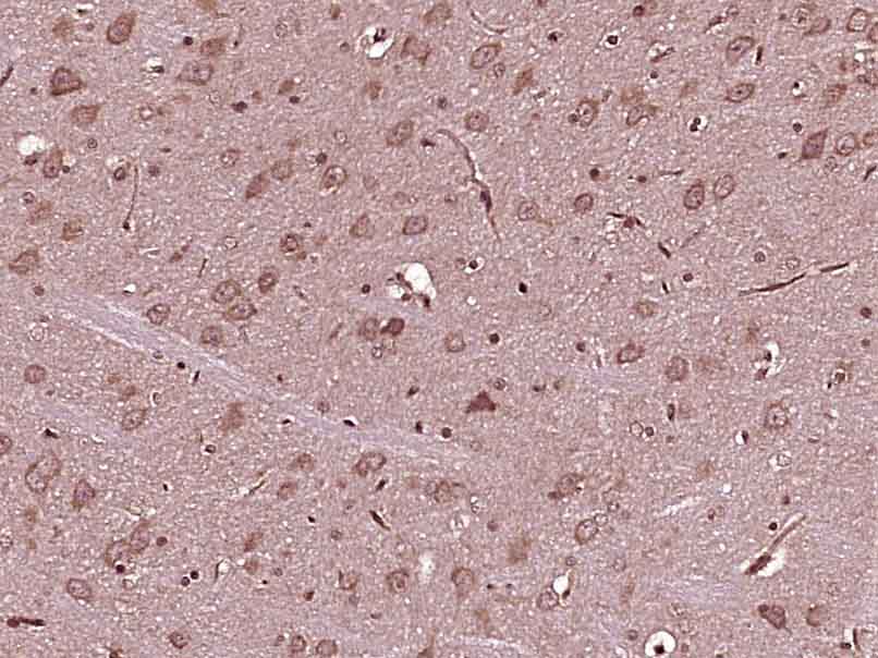 14 - FGD5 Rabbit pAb AP56111