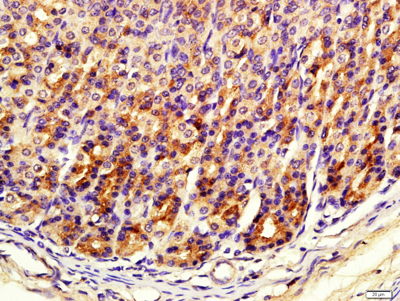 14 - FITM1 Rabbit pAb AP56116