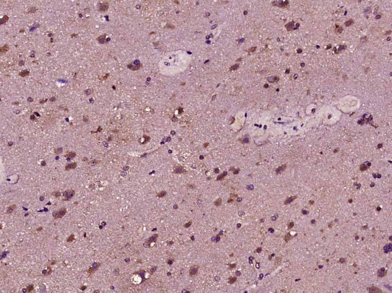 14 - FLJ27365 Rabbit pAb AP56127