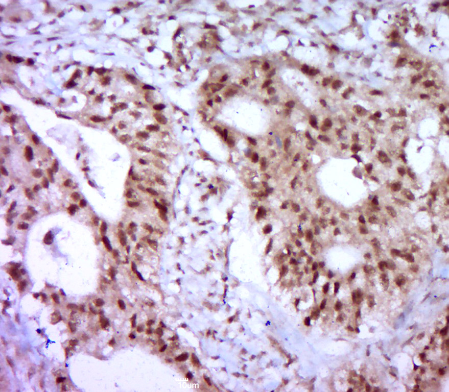 14 - ZNF778 Rabbit pAb AP56130