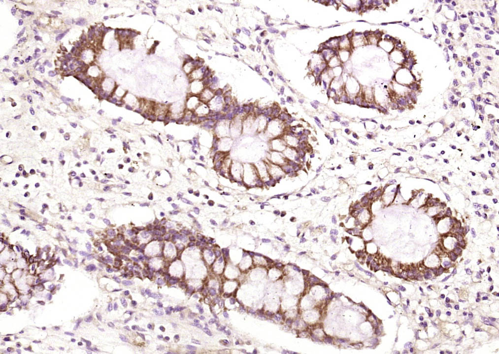 14 - FMNL3 Rabbit pAb AP56152