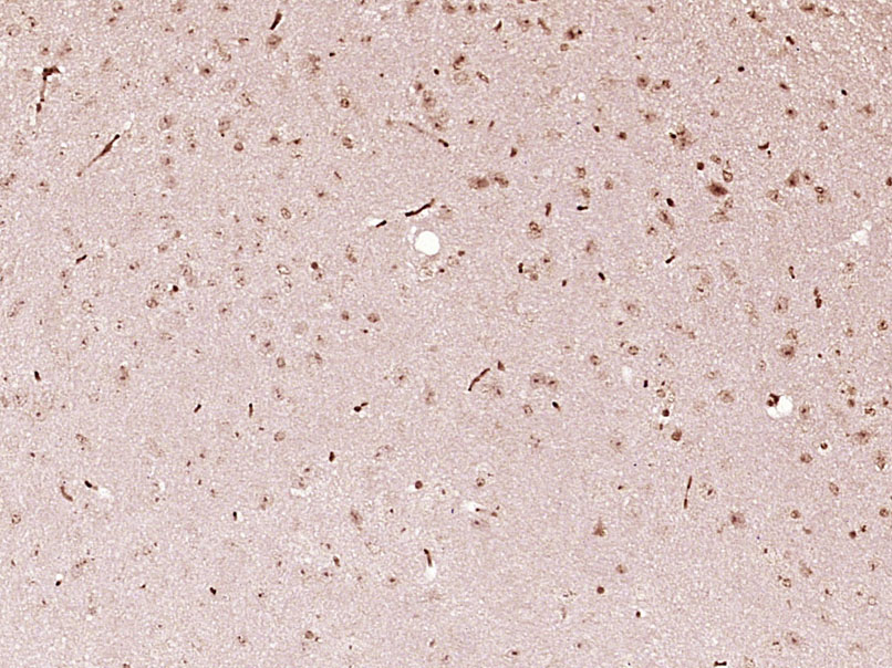 14 - FOXJ3 Rabbit pAb AP56163