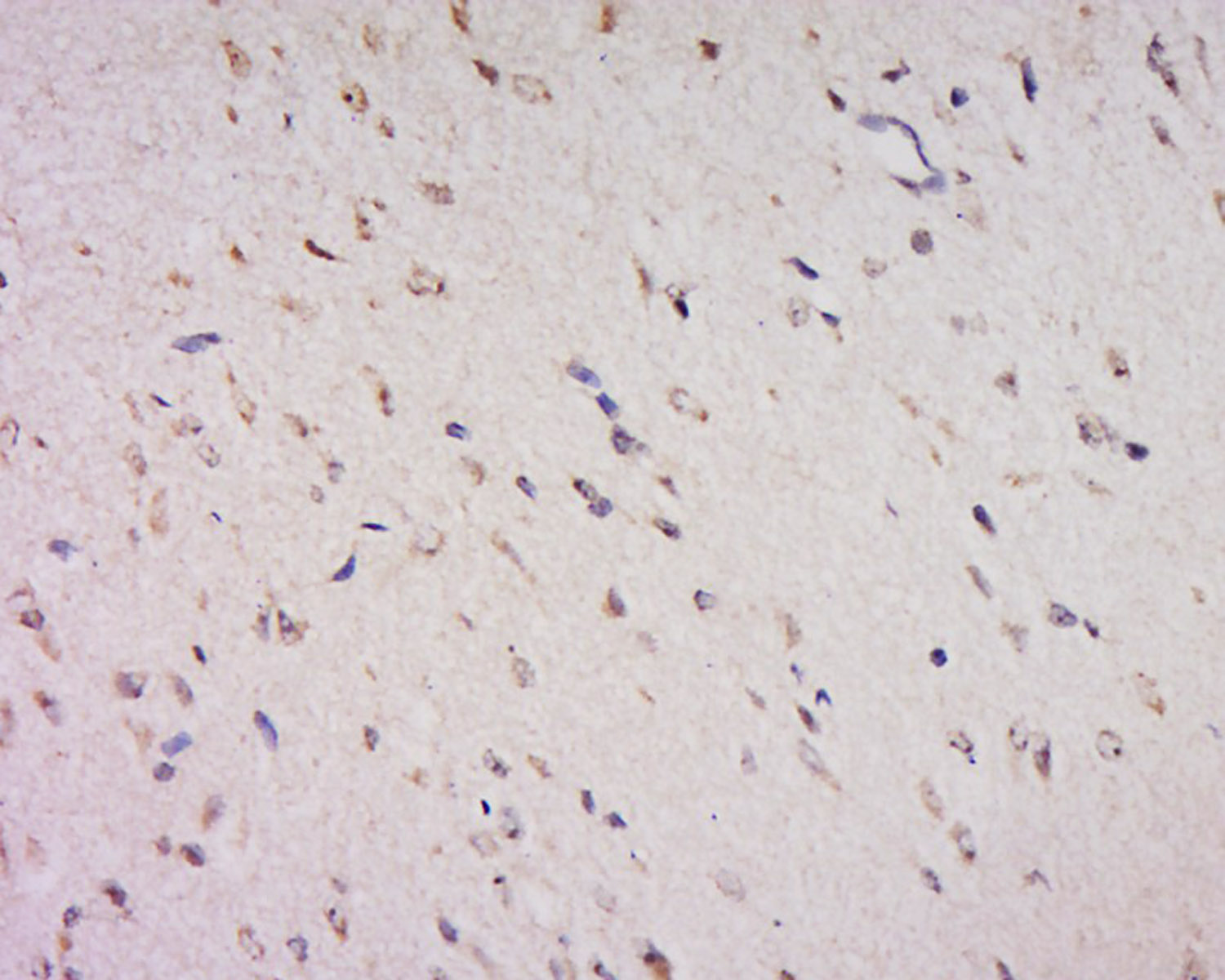 14 - FOXS1 Rabbit pAb AP56165