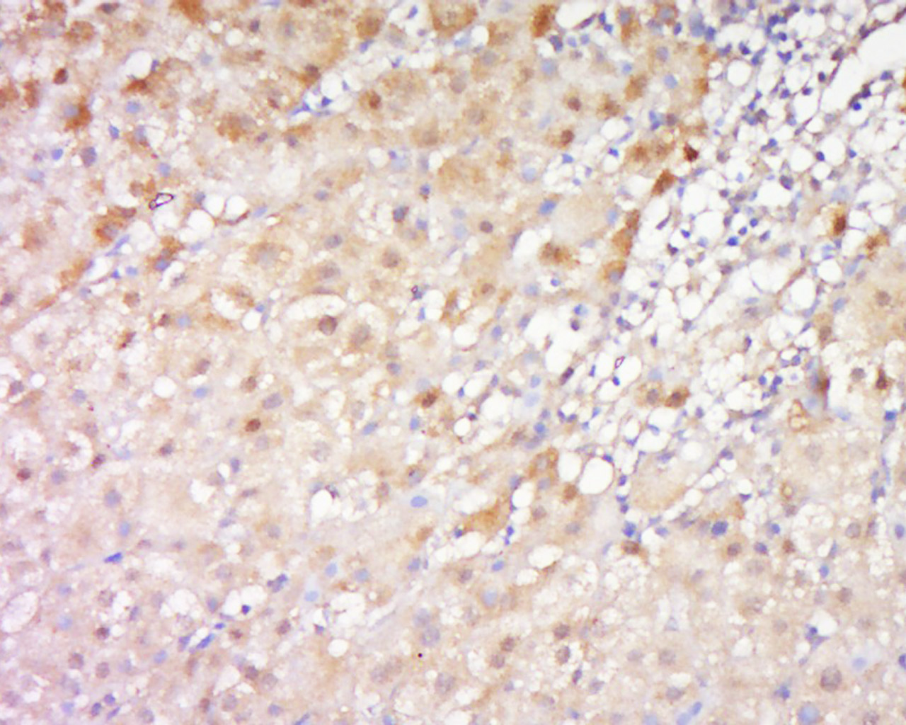 14 - FRY/C13orf14 Rabbit pAb AP56168