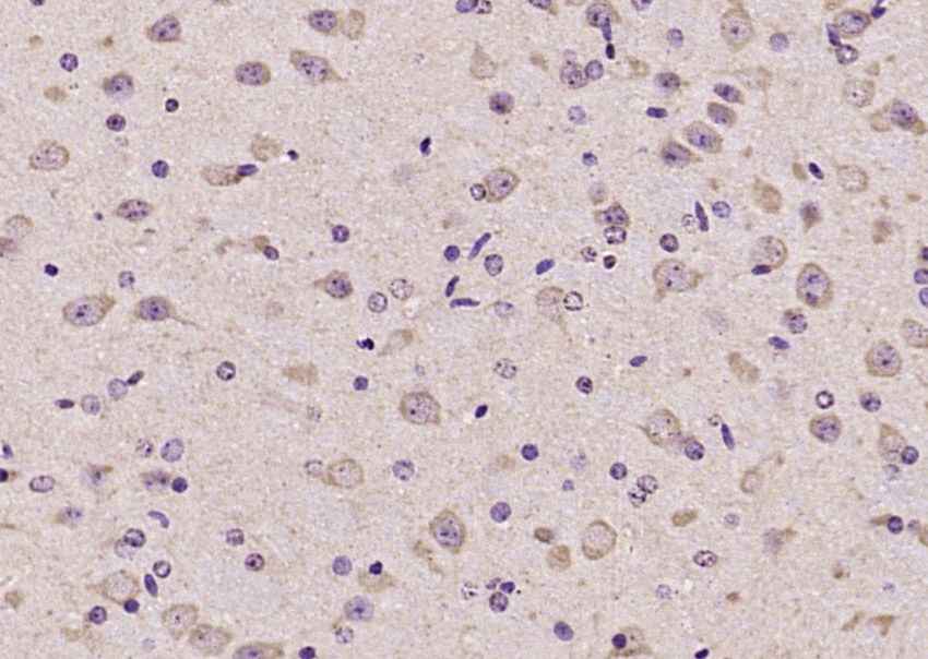 14 - FSIP2 Rabbit pAb AP56171