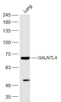 1 - GALNTL4 Rabbit pAb AP56182