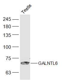 1 - GALNTL6 Rabbit pAb AP56183