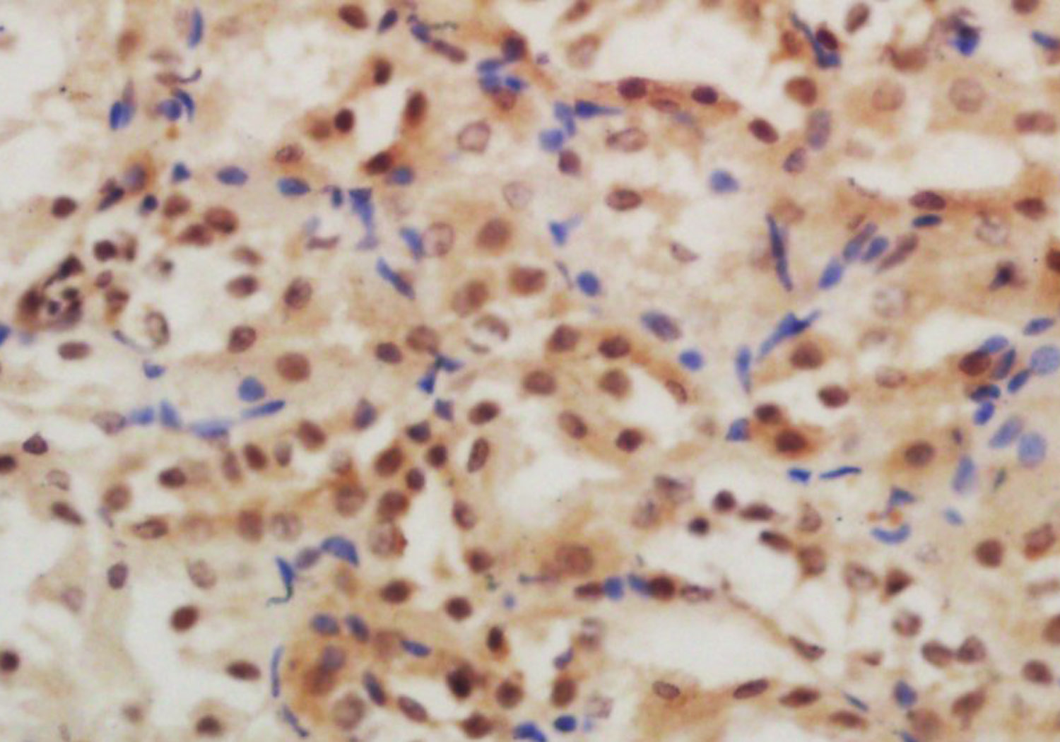 14 - GLIS3 Rabbit pAb AP56188