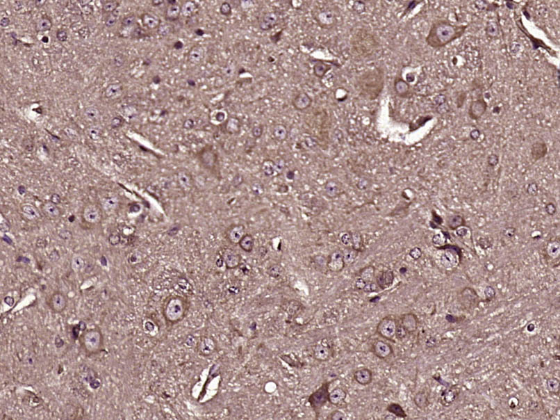 14 - GLOD4 Rabbit pAb AP56189