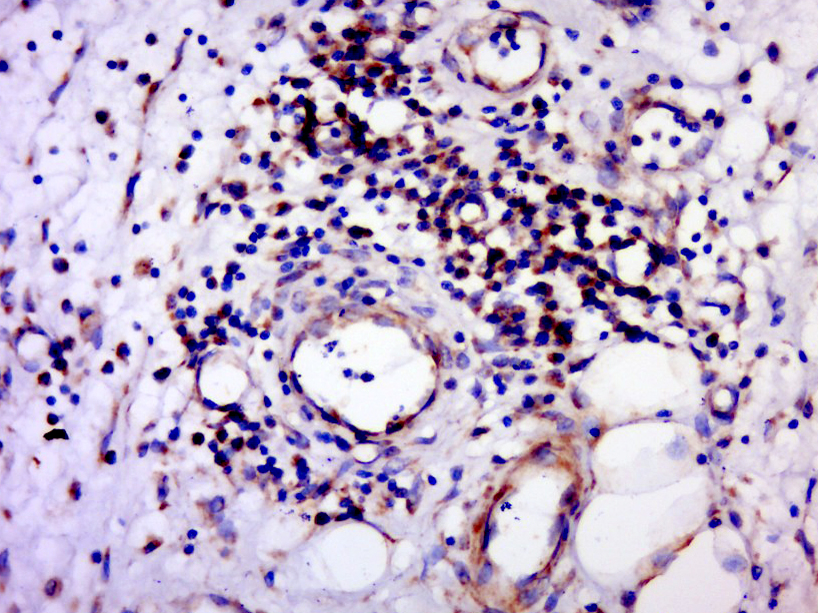 14 - GPCR150 Rabbit pAb AP56198