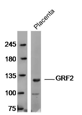 1 - GRF2 Rabbit pAb AP56215