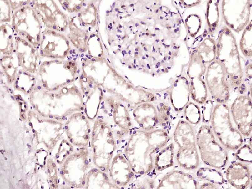 14 - GTF3C5 Rabbit pAb AP56230