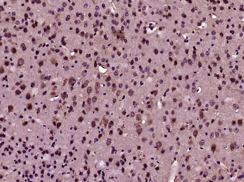 14 - GTL3 Rabbit pAb AP56232