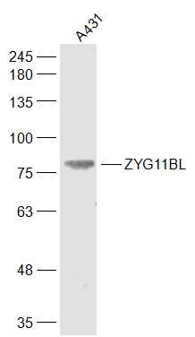 1 - ZYG11BL Rabbit pAb AP56239