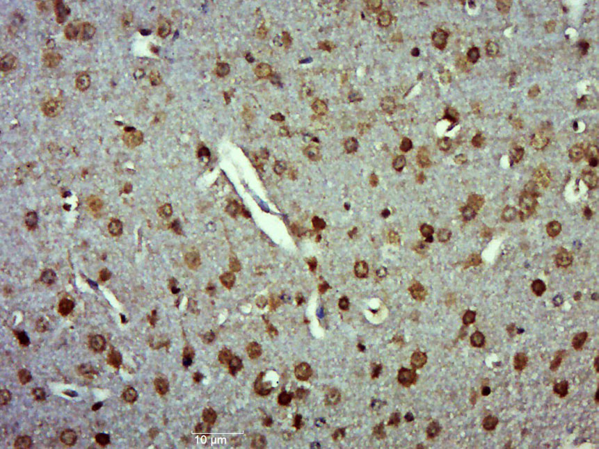 14 - ZSWIM6 Rabbit pAb AP56244