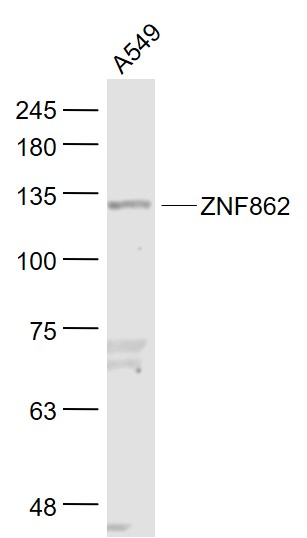 1 - ZNF862 Rabbit pAb AP56255