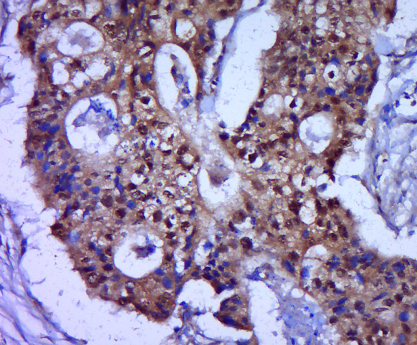 14 - ZNF793 Rabbit pAb AP56265