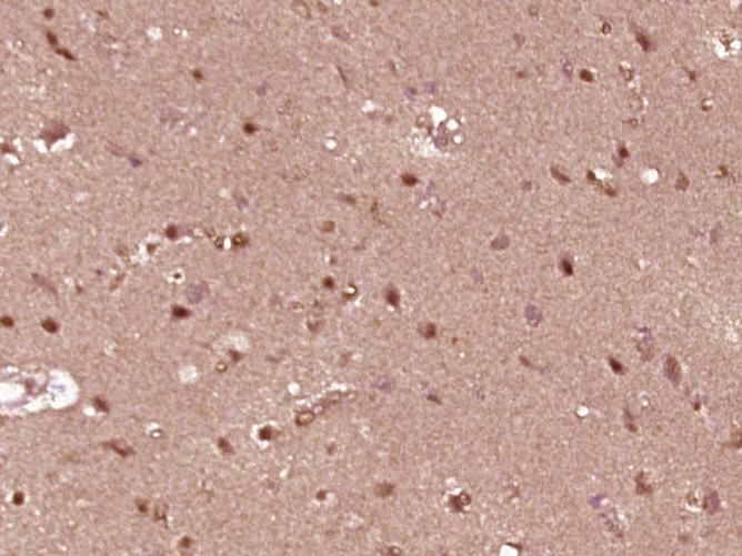 14 - ZNF777 Rabbit pAb AP56272