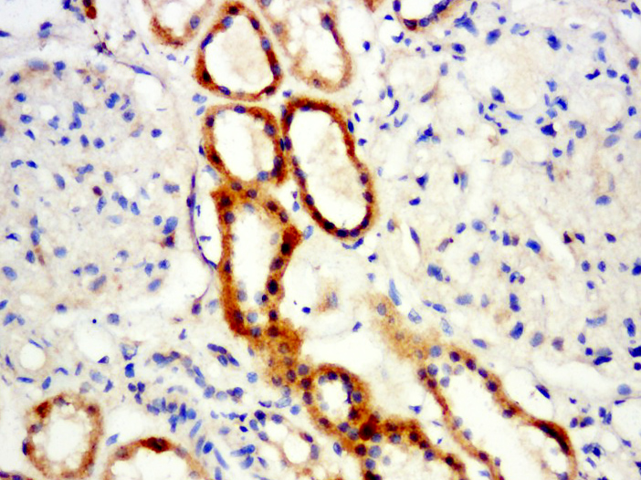 14 - Hemoglobin subunit delta Rabbit pAb AP56276