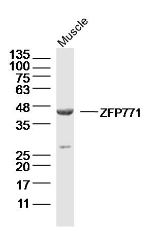 1 - ZFP771 Rabbit pAb AP56284