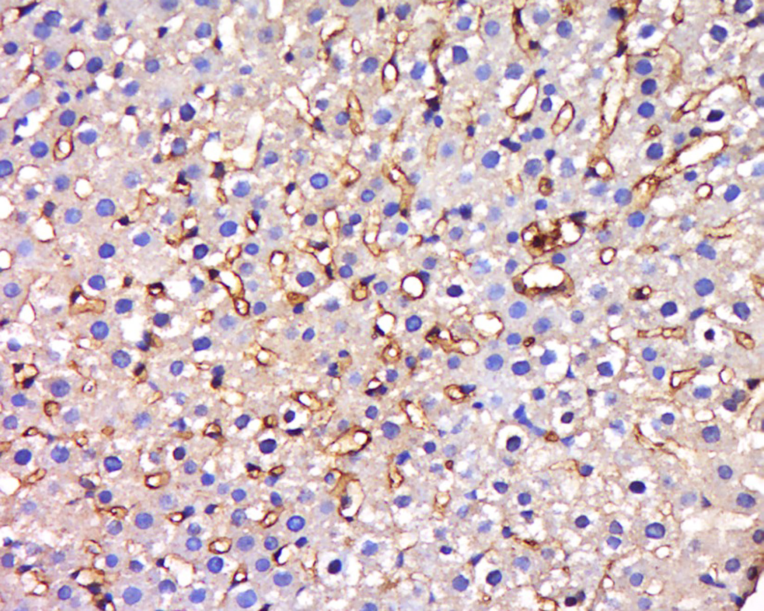 14 - HIATL1 Rabbit pAb AP56295