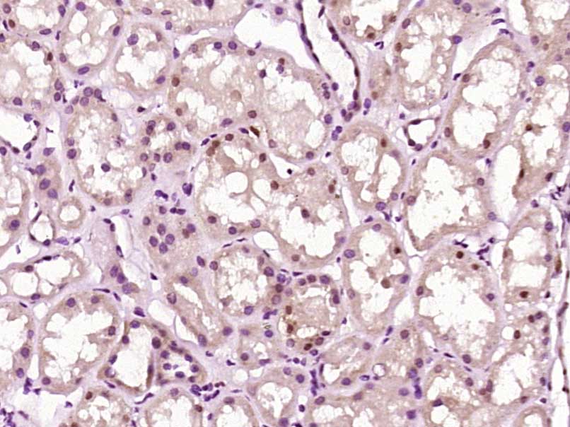 14 - ZNF687 Rabbit pAb AP56302