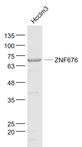 1 - ZNF676 Rabbit pAb AP56304