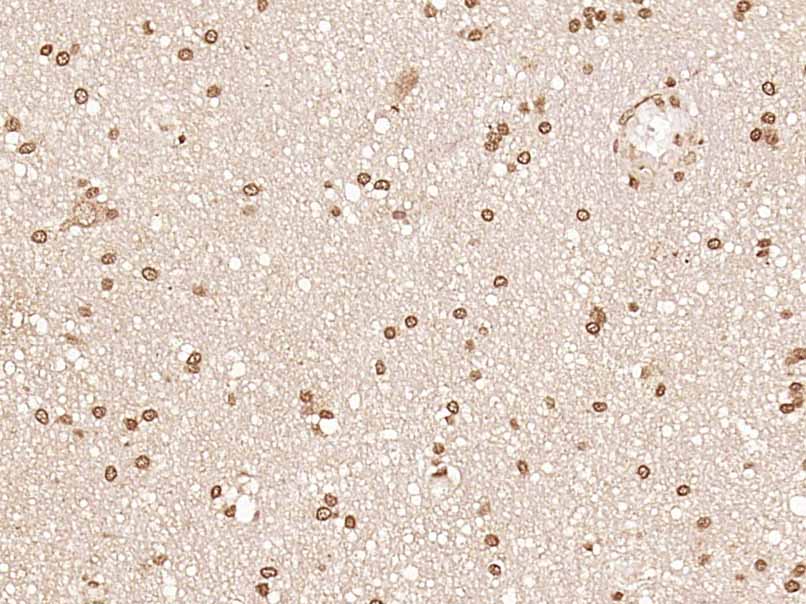 14 - ZNF676 Rabbit pAb AP56304