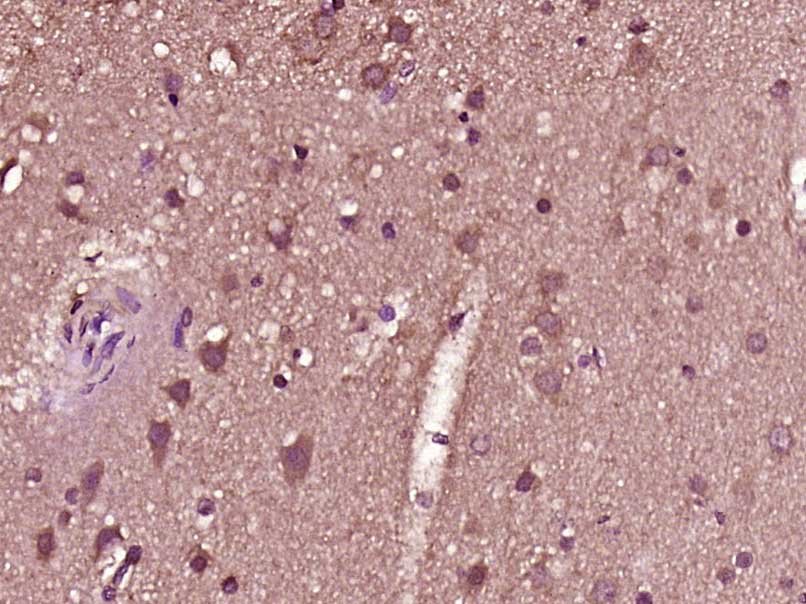 14 - ZNF683 Rabbit pAb AP56308