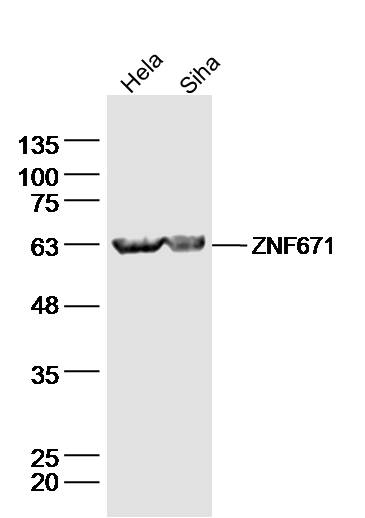 1 - ZNF671 Rabbit pAb AP56309